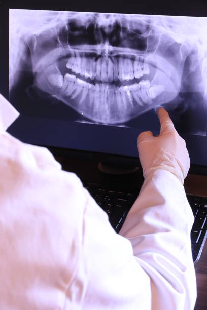 Best Urgent Care for Lost Fillings or Crowns in Clarksville, VA
